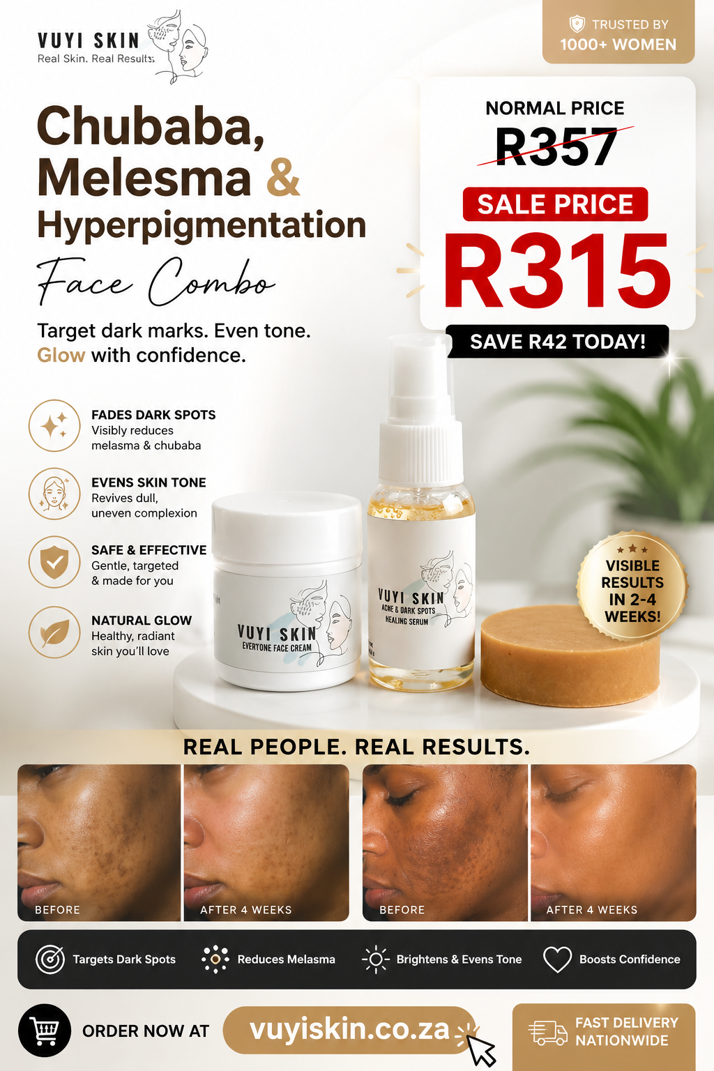 Our Best-Selling Melasma, Chubaba & Hyperpigmentation Treatment for Clearer, Even-Toned Skin