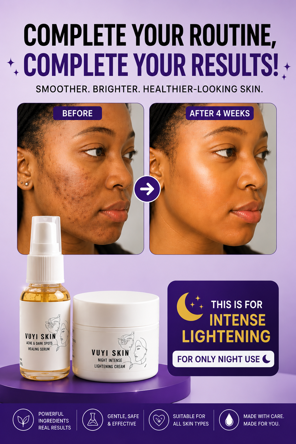 Your Complete Night Routine — Intense Lightening For Hyperpigmentation, Dark Marks &amp; Chubaba