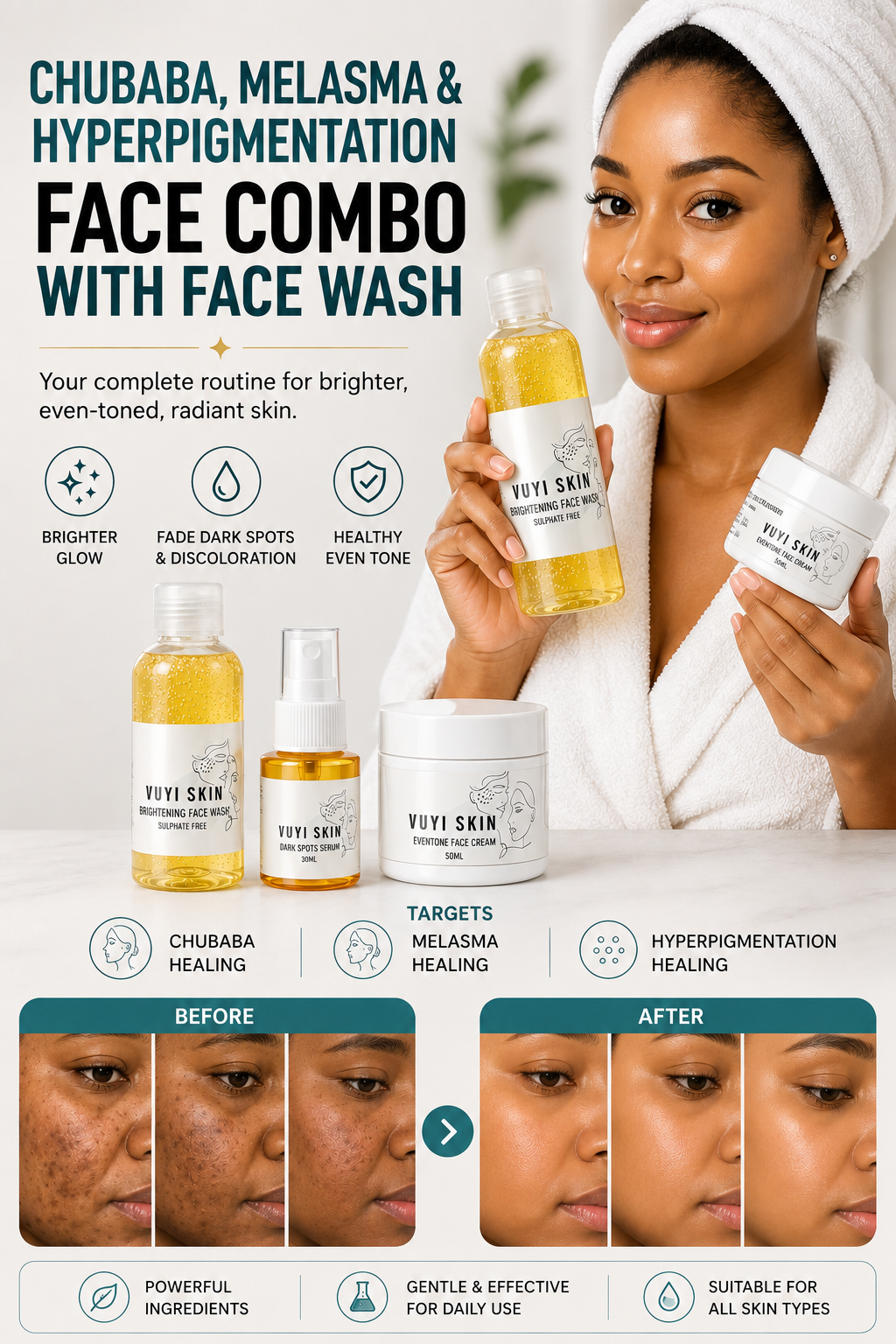 Chubaba, Melasma & Hyperpigmentation Face Combo with Face Wash