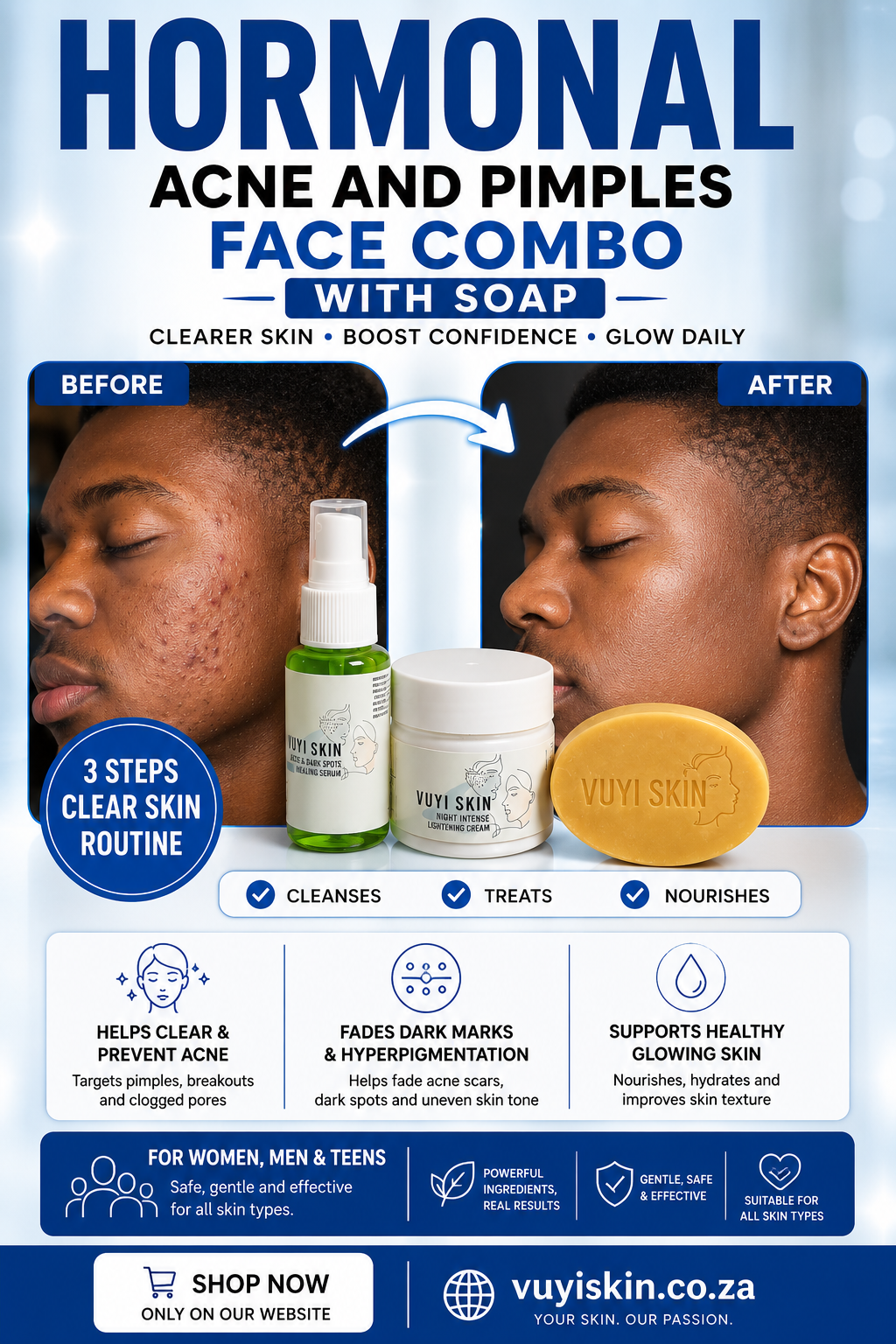 Clear Men's Hormonal Acne & Pimples