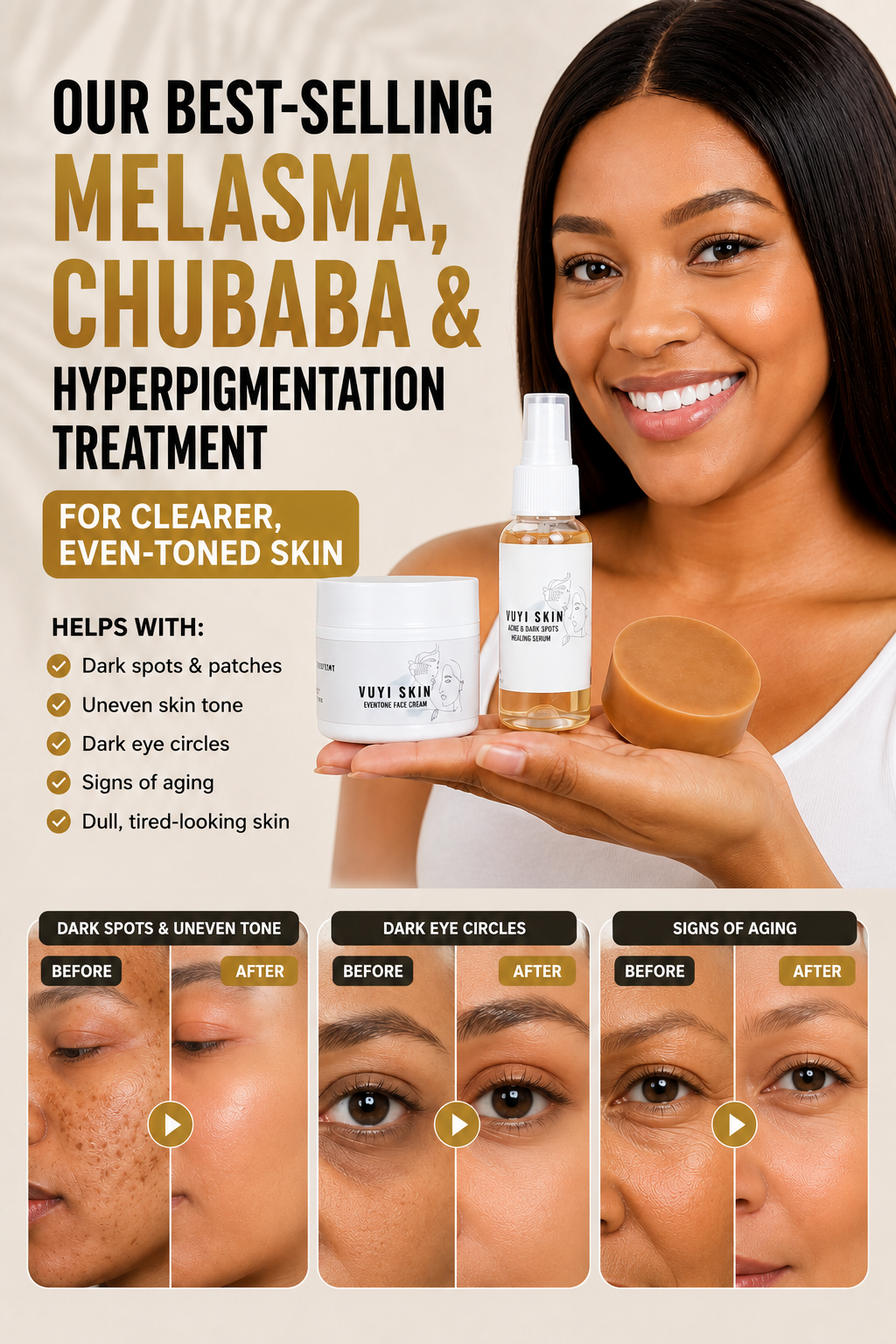 Our Best-Selling Melasma, Chubaba & Hyperpigmentation Treatment for Clearer, Even-Toned Skin