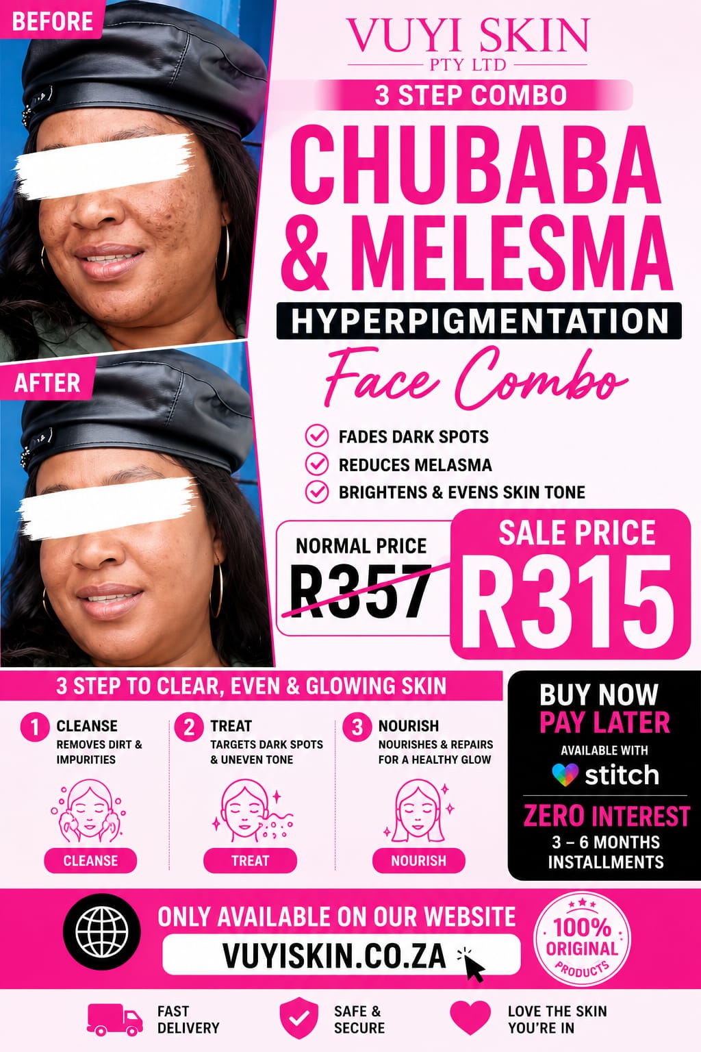 Our Best-Selling Melasma, Chubaba & Hyperpigmentation Treatment for Clearer, Even-Toned Skin